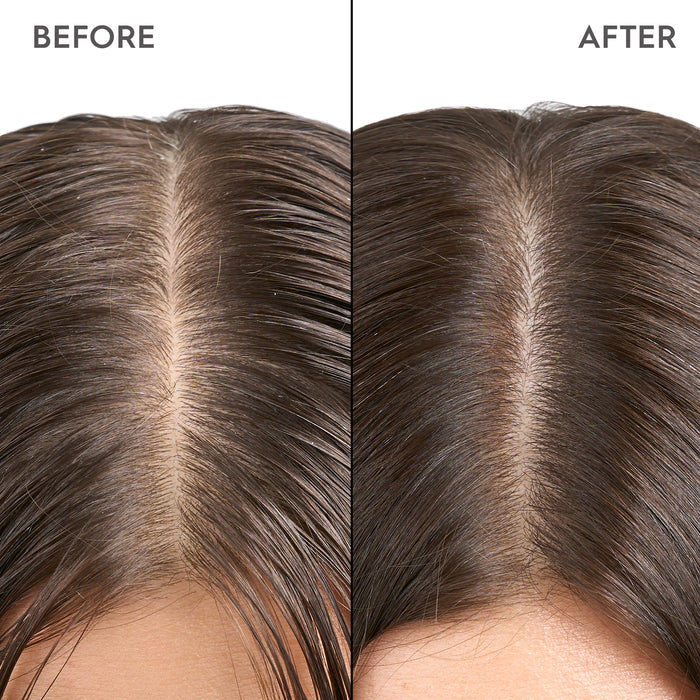 Kerasilk Specialist Exfoliating Scalp & Hair Treatment 200ml