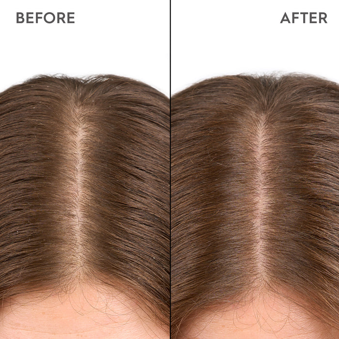 Kerasilk Specialist Moisturizing Scalp Drops 100ml